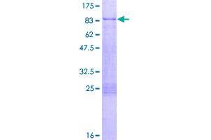 Image no. 1 for Estrogen Receptor 1 (ESR1) (AA 1-595) protein (GST tag) (ABIN1353124)