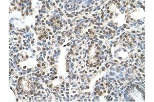 MAGEA8 antibody was used for immunohistochemistry at a concentration of 16. (MAGEA8 anticorps  (N-Term))