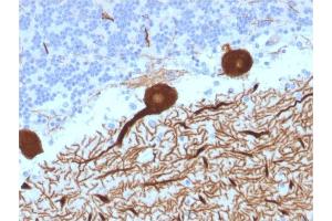 Formalin-fixed, paraffin-embedded human Cerebellum stained with CA8 Mouse Monoclonal Antibody (CPTC-CA8-2). (CA8 anticorps)