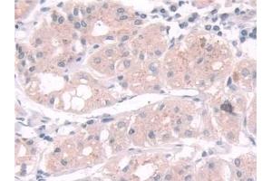 Detection of TPMT in Human Stomach Tissue using Polyclonal Antibody to Thiopurine Methyltransferase (TPMT)