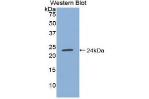 Detection of Recombinant TIMP4, Human using Polyclonal Antibody to Tissue Inhibitors Of Metalloproteinase 4 (TIMP4) (TIMP4 anticorps  (AA 32-224))
