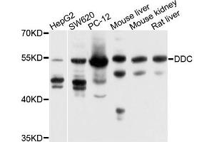 Western blot analysis of extracts of various cells, using DDC antibody. (DDC anticorps)