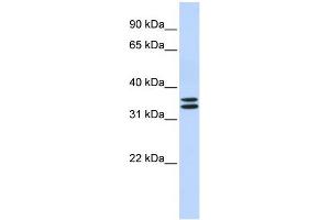 WB Suggested Anti-TAL1 Antibody Titration: 0. (TAL1 anticorps  (N-Term))
