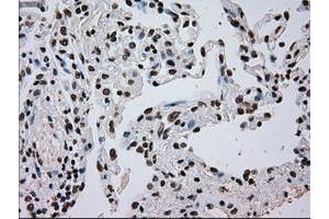 Image no. 11 for anti-TYRO3 Protein Tyrosine Kinase (TYRO3) antibody (ABIN1501607)