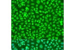 Immunofluorescence analysis of U2OS cells using COQ7 Polyclonal Antibody at dilution of 1:100. (Coq7 anticorps)