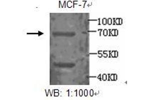 Image no. 1 for anti-Estrogen Receptor 1 (ESR1) antibody (ABIN790861) (Estrogen Receptor alpha anticorps)