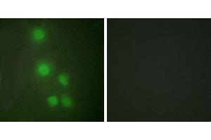 Peptide - +Western blot analysis of extracts from Jurkat cells and COLO205 cells, using ACL6A antibody. (BAF53A anticorps  (Internal Region))