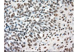 Immunohistochemical staining of paraffin-embedded colon tissue using anti-TYRO3mouse monoclonal antibody. (TYRO3 anticorps)