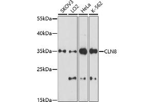 Western blot analysis of extracts of various cell lines, using CLN8 antibody (ABIN7266285) at 1:1000 dilution. (CLN8 anticorps)