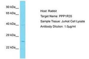 Image no. 1 for anti-Protein Phosphatase 1, Regulatory Subunit 35 (PPP1R35) (N-Term) antibody (ABIN6750778) (PPP1R35 anticorps  (N-Term))