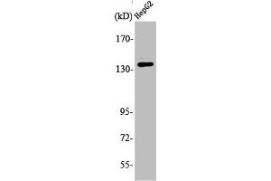 Western Blot analysis of 293 cells using Ataxin-2 Polyclonal Antibody (Ataxin 2 anticorps  (Internal Region))