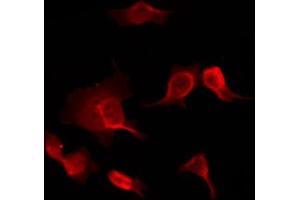 ABIN6267033 staining HuvEc by IF/ICC. (PIM1 anticorps  (Internal Region))