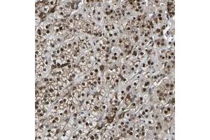 Immunohistochemical staining of human adrenal gland with RRP1B polyclonal antibody  shows strong nuclear positivity in cortical cells at 1:500-1:1000 dilution. (RRP1B anticorps)