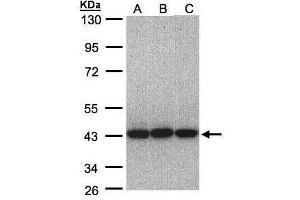 WB Image Sample(30 ug whole cell lysate) A:A431, B:H1299 C:Hep G2 , 10% SDS PAGE antibody diluted at 1:1000 (EIF3H anticorps)