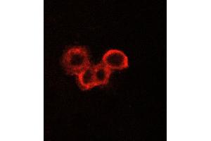 ABIN6269075 staining A549 cells by ICC/IF. (EGFR anticorps  (C-Term))