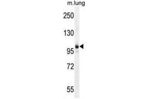 AEBP1 Antibody (Center) western blot analysis in mouse lung tissue lysates (35µg/lane).