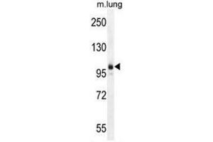AEBP1 Antibody (Center) western blot analysis in mouse lung tissue lysates (35µg/lane). (AEBP1 anticorps  (Middle Region))