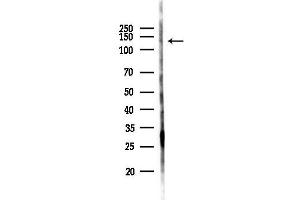 Western blot analysis of lysates from Hela cells(starvation 24h treatment), using TYRO3 Antibody at 1/1000 dilution.