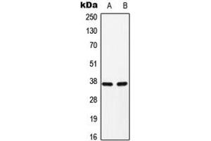 Western blot analysis of C/EBP alpha (pS193) expression in H9C2 (A), Raw264.