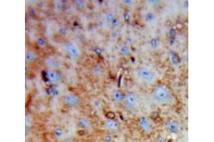 Used in DAB staining on fromalin fixed paraffin-embedded Brain tissue (DPYSL3 anticorps  (AA 1-218))