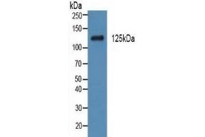 Rabbit Detection antibody from the kit in WB with Positive Control: Human testis tissue. (PDGFRA Kit ELISA)