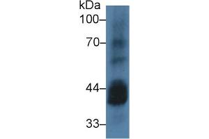 Western blot analysis of Mouse Testis lysate, using Human CSNK1a1 Antibody (3 µg/ml) and HRP-conjugated Goat Anti-Rabbit antibody ( (CSNK1A1 anticorps  (AA 130-337))