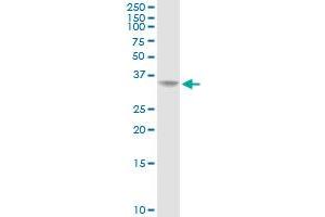 AKR1C2 MaxPab rabbit polyclonal antibody. (AKR1C2 anticorps  (AA 1-323))