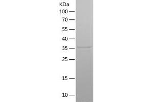 Western Blotting (WB) image for phosphorylase, Glycogen, Liver (PYGL) (AA 745-847) protein (His-IF2DI Tag) (ABIN7124446)