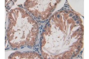 Used in DAB staining on fromalin fixed paraffin- embedded stomach tissue