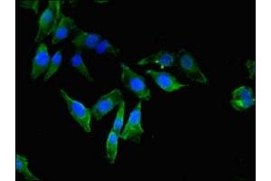 Immunofluorescent analysis of Hela cells using ABIN7152101 at dilution of 1:100 and Alexa Fluor 488-congugated AffiniPure Goat Anti-Rabbit IgG(H+L)