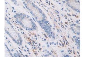 Figure. (PZP anticorps  (AA 1212-1391))