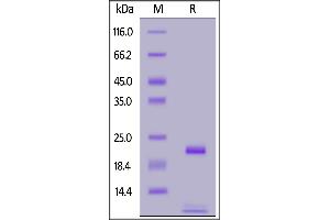 Biotinylated Human FGF basic, Avitag,His Tag on  under reducing (R) condition.