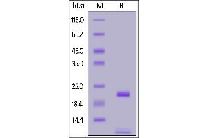 Biotinylated Human FGF basic, Avitag,His Tag on  under reducing (R) condition. (FGF2 Protein (AA 143-288) (AVI tag,His tag,Biotin))