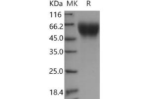 Western Blotting (WB) image for Interleukin 17 Receptor A (IL17RA) (Active) protein (His tag) (ABIN7196418)