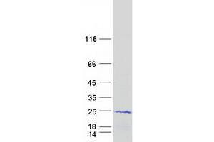 Validation with Western Blot