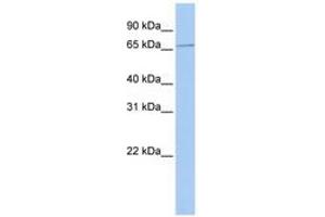 Image no. 1 for anti-Sex Comb On Midleg Homolog 1 (SCMH1) (AA 180-229) antibody (ABIN6740271) (SCMH1 anticorps  (AA 180-229))