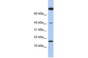 IL4 antibody used at 1 ug/ml to detect target protein. (IL-4 anticorps  (Middle Region))