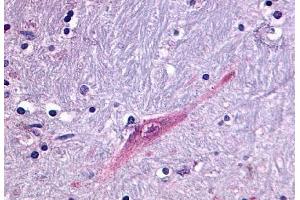 Anti-GPR55 antibody  ABIN1048838 IHC staining of human brain, putamen.