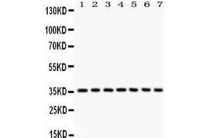 Western Blotting (WB) image for anti-Nuclear Factor of kappa Light Polypeptide Gene Enhancer in B-Cells Inhibitor, alpha (NFKBIA) (AA 3-112) antibody (ABIN3043889)