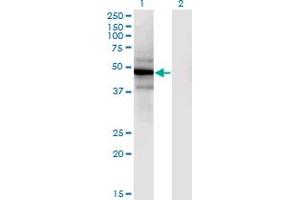 Western Blot analysis of SLC25A25 expression in transfected 293T cell line by SLC25A25 monoclonal antibody (M02), clone 4D8. (SLC25A25 anticorps  (AA 2-110))