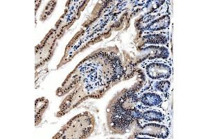 IHC analysis of SNRNP200 using anti-SNRNP200 antibody (ABIN7602032).