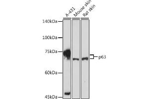 Western blot analysis of extracts of various cell lines, using p63 antibody (ABIN3023011, ABIN3023012, ABIN3023013, ABIN1513632 and ABIN6219346) at 1:1000 dilution.