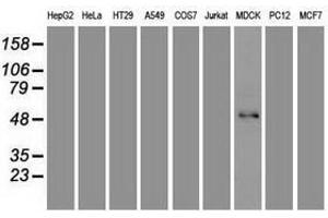 Image no. 2 for anti-Forkhead Box A1 (FOXA1) (AA 1-473) antibody (ABIN1490773) (FOXA1 anticorps  (AA 1-473))