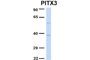 Host:  Rabbit  Target Name:  PITX3  Sample Type:  Human Fetal Liver  Antibody Dilution:  1. (PITX3 anticorps  (Middle Region))