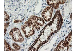 Image no. 4 for anti-Adenylate Kinase 4 (AK4) antibody (ABIN1496526)