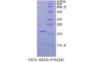 SDS-PAGE analysis of Human GaA Protein. (GAA Protéine)
