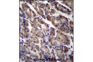 ABRA Antibody (C-term) (ABIN656755 and ABIN2845977) immunohistochemistry analysis in formalin fixed and paraffin embedded human stomach tissue followed by peroxidase conjugation of the secondary antibody and DAB staining. (ABRA anticorps  (C-Term))