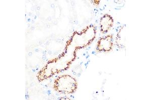 Immunohistochemistry of paraffin-embedded rat kidney using OSR1 Rabbit pAb (ABIN7269080) at dilution of 1:100 (40x lens).