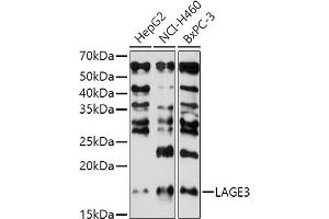 Western blot analysis of extracts of various cell lines, using L antibody (ABIN7268159) at 1:1000 dilution. (LAGE3 anticorps  (AA 1-143))