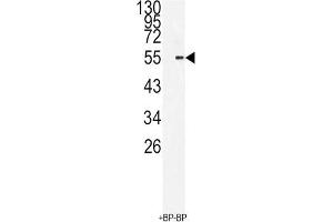 Western Blotting (WB) image for anti-BMI1 Polycomb Ring Finger Oncogene (BMI1) antibody (ABIN3001536) (BMI1 anticorps)